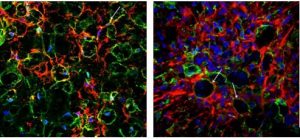 Kazan Federal University scientists studying extracellular matrix and microglial cells in the injured spinal cord to develop new strategies for restoring lost functions